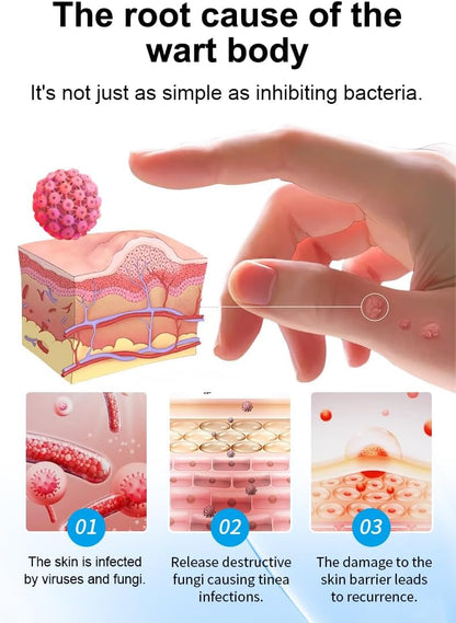 DermaTag Removal Kit