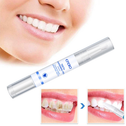 1+1 FREE | Smiley™ - Teeth Whitener