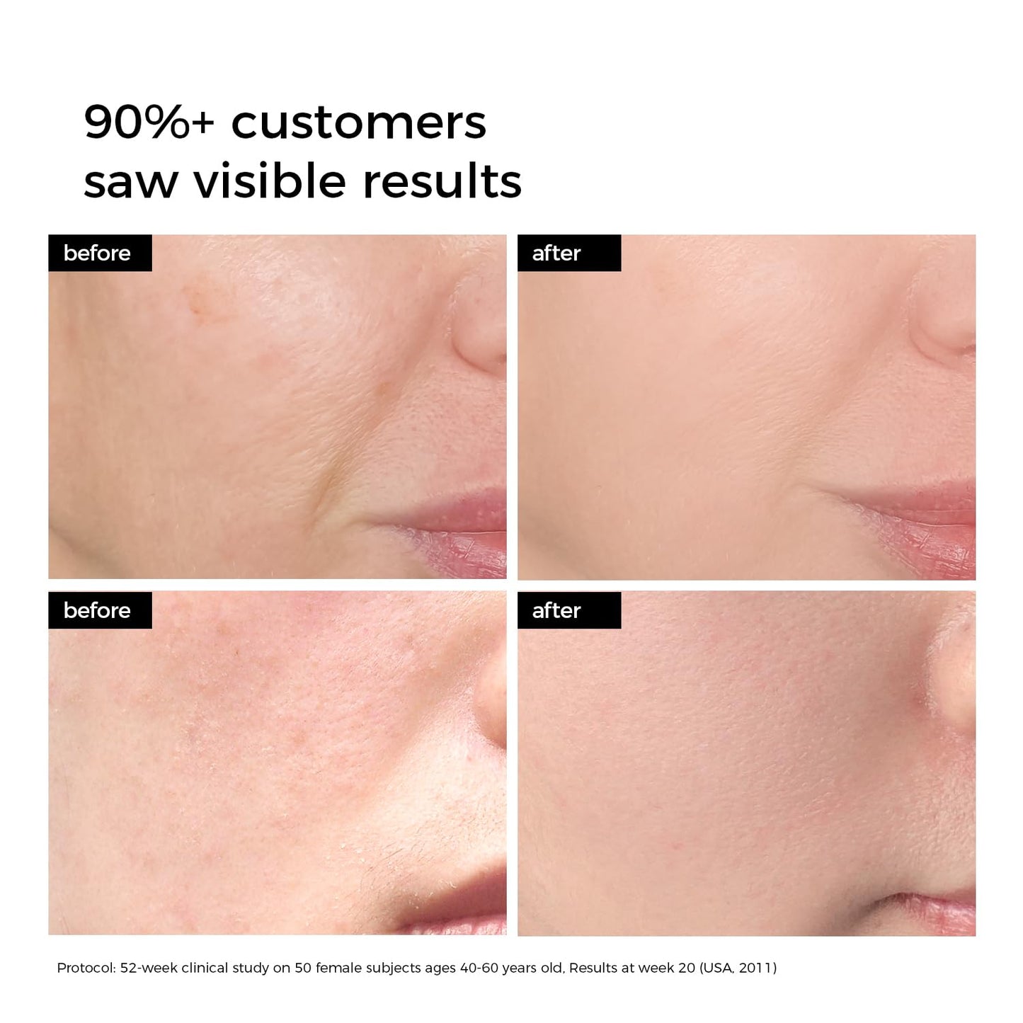 Caedrea™ Ultra Hydration – 3% Hyaluronic Acid Serum