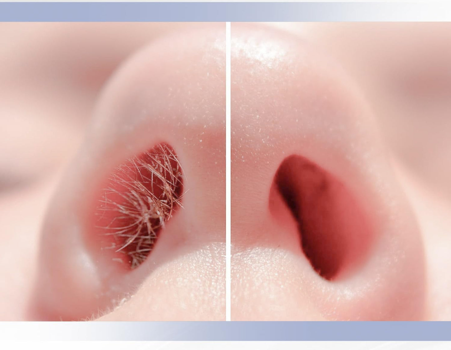 NoseTrim™ – Painless Nose Hair Trimmer