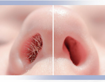 NoseTrim™ – Painless Nose Hair Trimmer