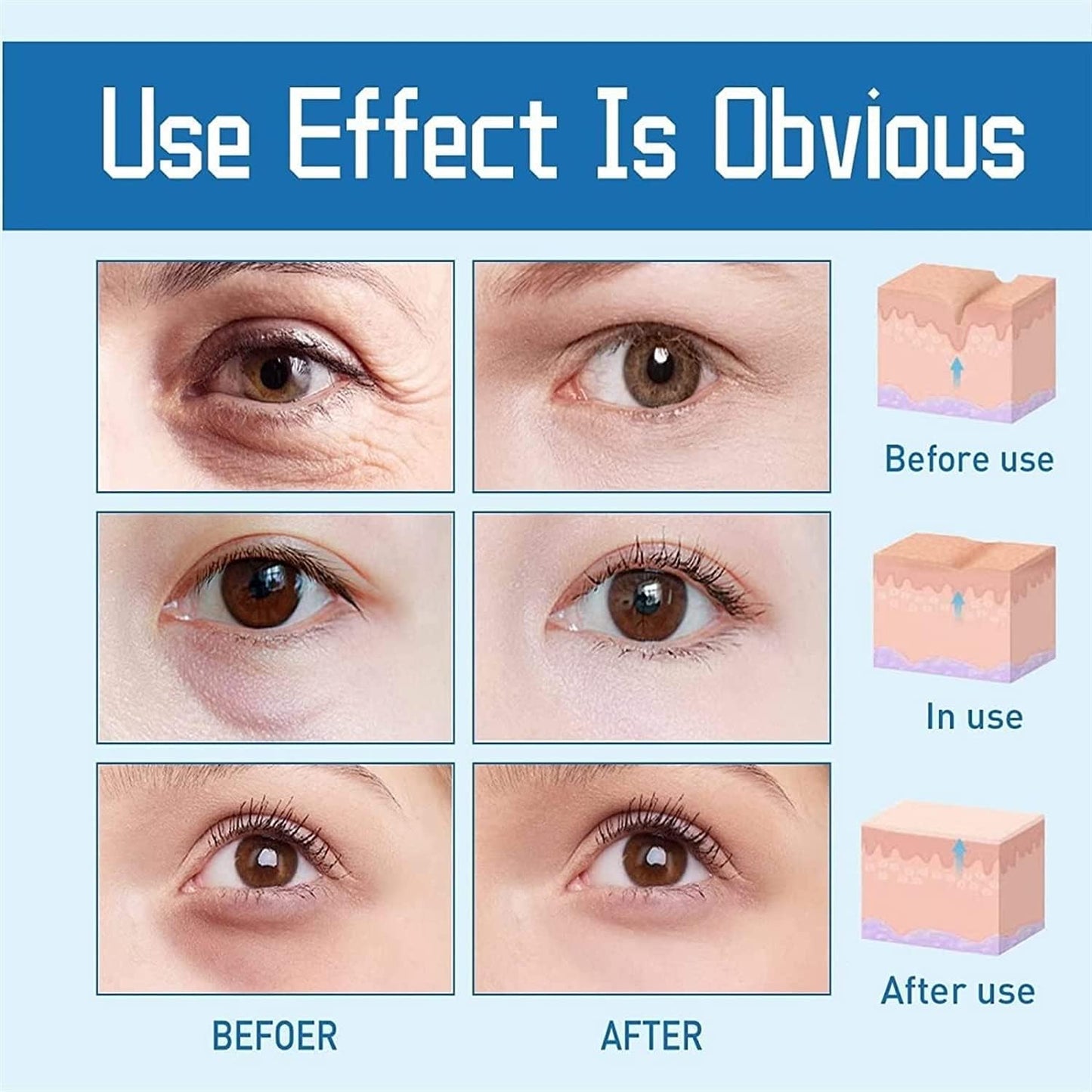 CaedWrinkle Eye Serum | Anti-wrinkle Serum