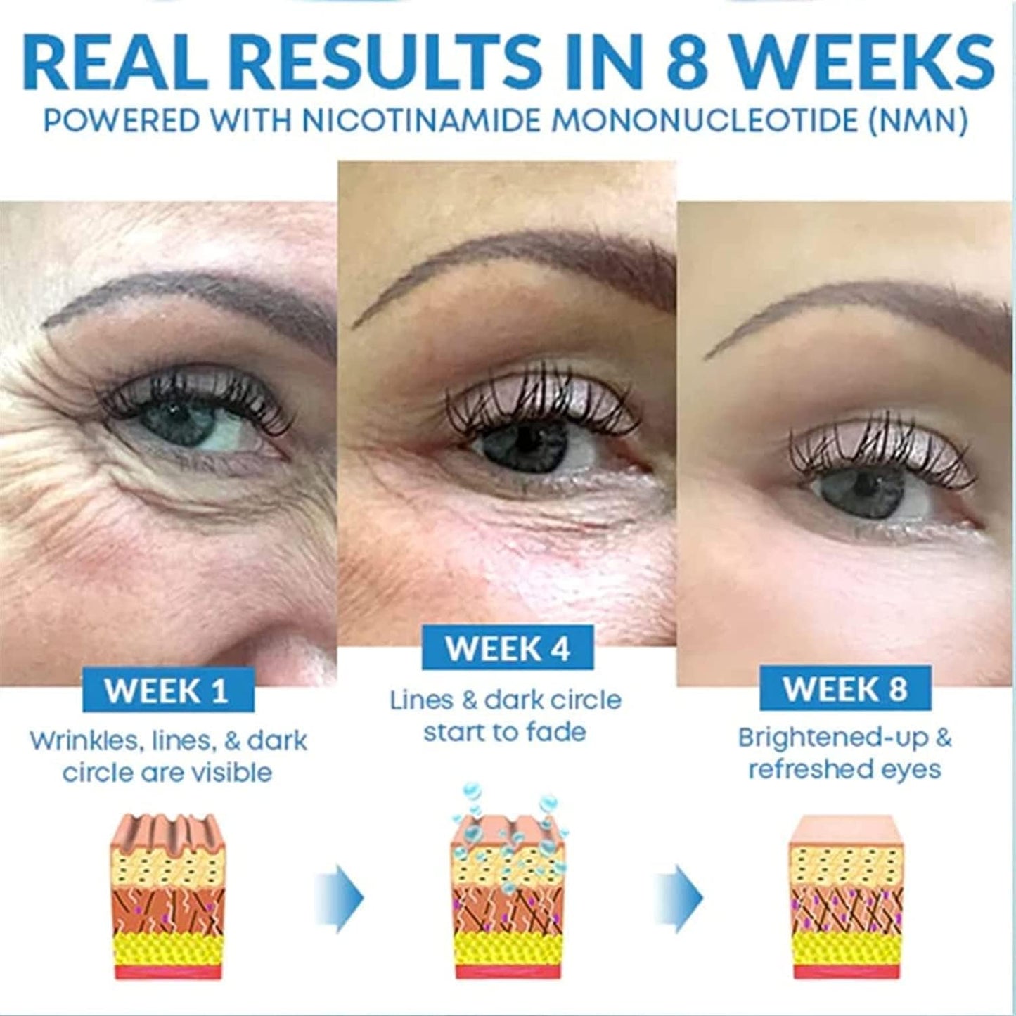 CaedWrinkle Eye Serum | Anti-wrinkle Serum
