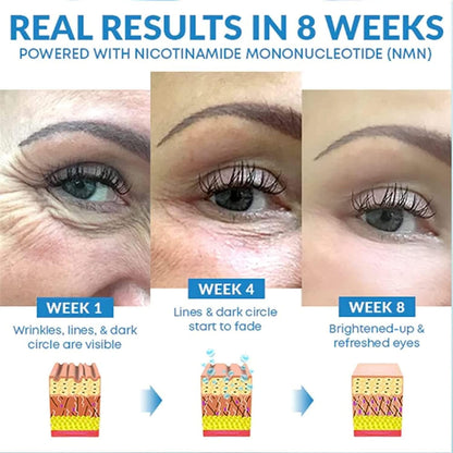 CaedWrinkle Eye Serum | Anti-wrinkle Serum
