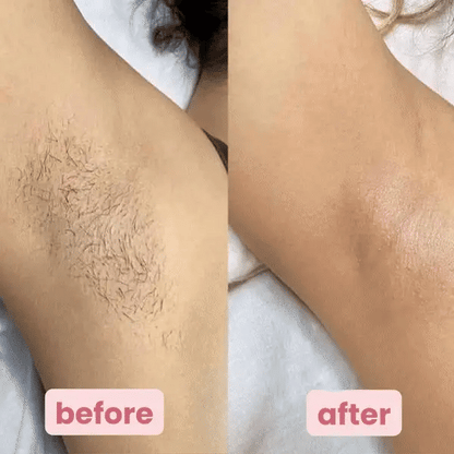 Smooth™ Shave Pro