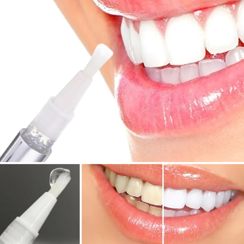 OralDentCare™ | Teeth Whitening Pen