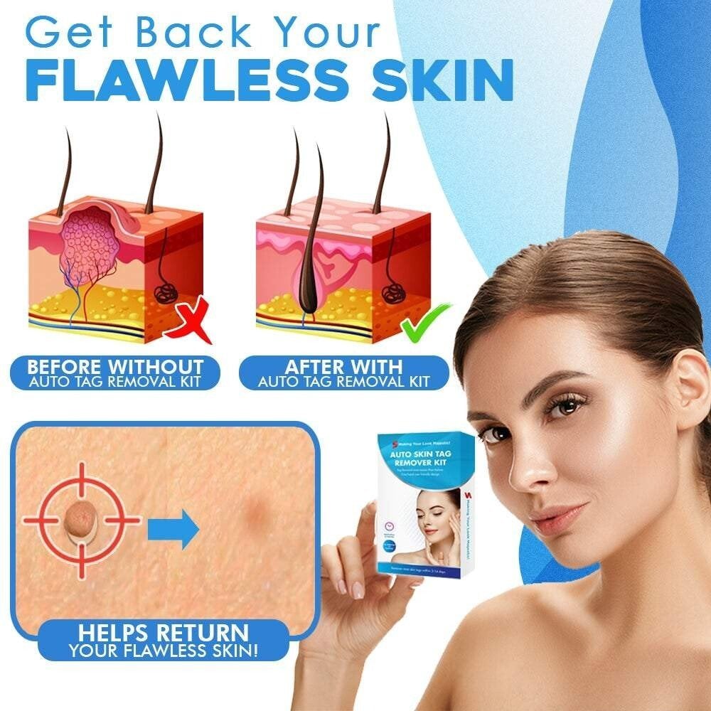 DermaTag Removal Kit