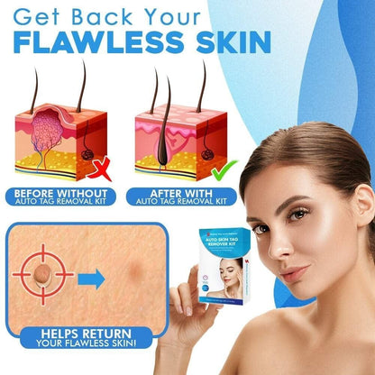 DermaTag Removal Kit