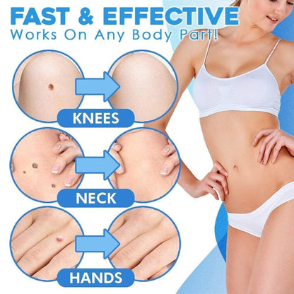 DermaTag Removal Kit