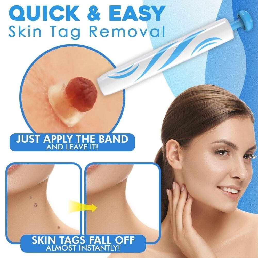 DermaTag Removal Kit