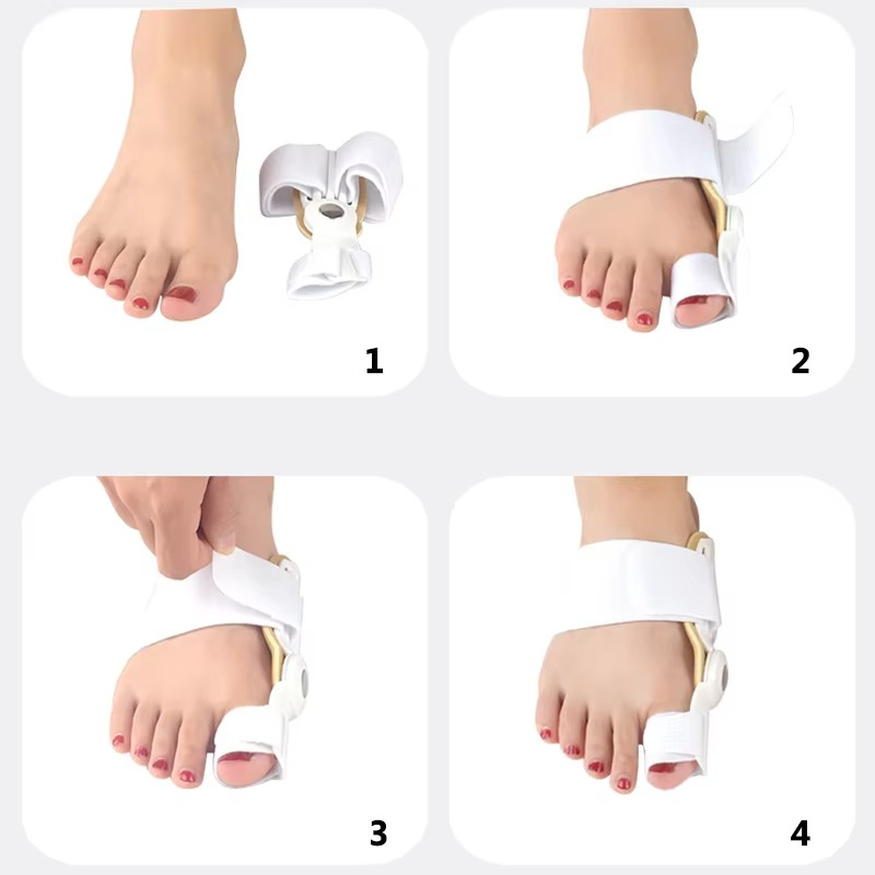 ToeFix™ - Adjustable Toe Alignment