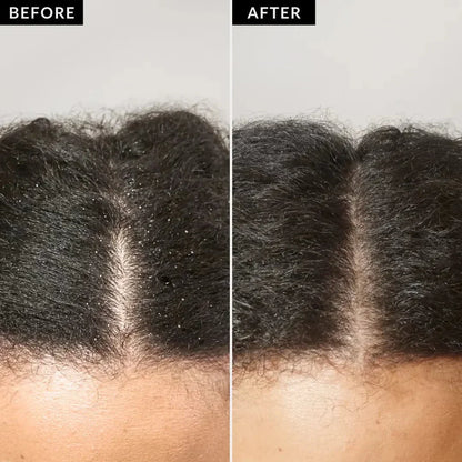 1+1 FREE I SilkGlide™ – Detangler Scalp Stimulator